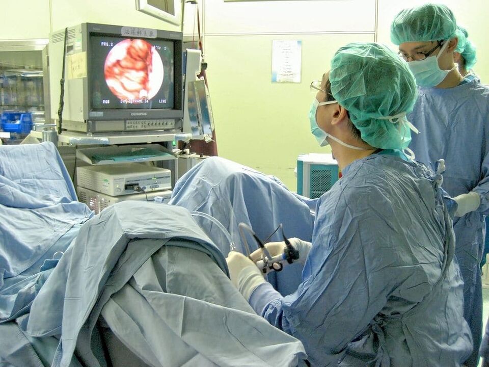 درمان جراحی پروستاتیت سنگی
